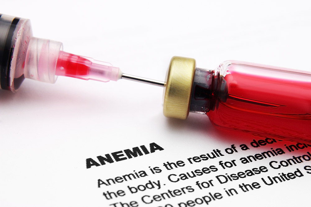 Notcia HIV Anemia Fev 23